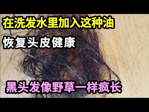 经常脱发、掉发，还秃顶的人，在洗发水里加入这种油，恢复头皮健康，黑头发像野草一样疯长！【家庭大医生】