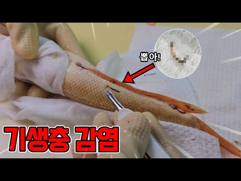 항문까지 파고드는 특이한 기생충 제거방법입니다..이대론 다 죽겠다!!