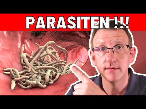 10 Frühwarnzeichen von Parasiten, die sofortiges Handeln erfordern!
