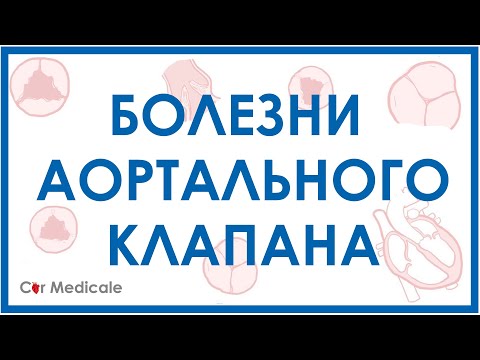 Болезни аортального клапана: аортальный стеноз, недостаточность аортального клапана.