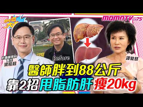 醫師胖到88公斤!! 靠2招甩 脂肪肝 瘦20kg ft. 梁程超 醫師  譚敦慈【 小宇宙大爆發 】