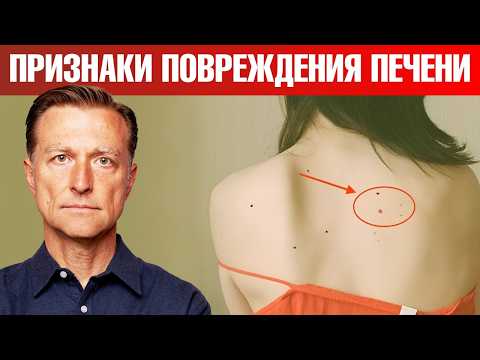 7 РАННИХ признаков повреждения печени 📢