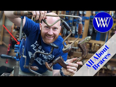 All About Braces What I actually Use