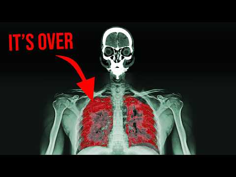 "It smelled funny while I was welding and now I can't breathe..."