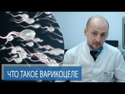 ЧТО ТАКОЕ ВАРИКОЦЕЛЕ? | Как варикоцеле может влиять на мужское бесплодие? | Часть 1