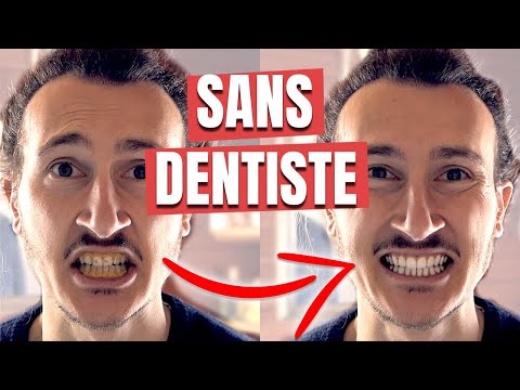 How to Prevent and Treat Tartar on Teeth Naturally? 🦷