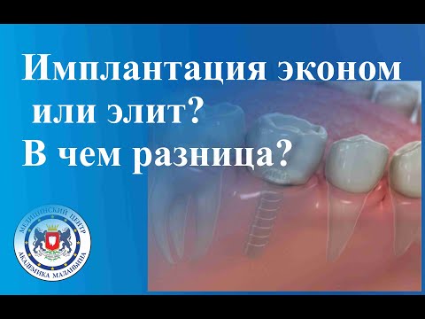 Имплантация эконом или элит? В чем разница?