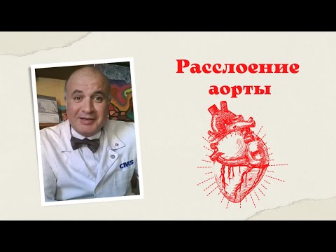 Диссекция. Расслоение и разрывы аорты: от причин до лечения