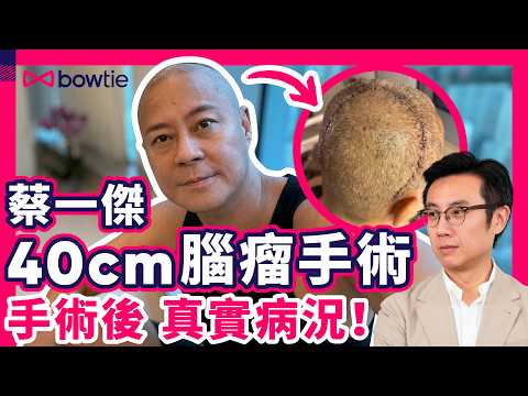 蔡一傑 親述 完成 切除腦部腫瘤手術 ｜ 腦癌 先要做 手術？40厘米 疤痕 屬罕見？｜ 蔡一傑 病況分析｜ 開腦手術 後遺症 最嚴重會 癲癇 ？｜#草蜢 #蔡一傑 #Bowtie