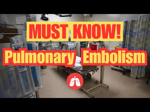 Pulmonary Embolism in the ER: What to Do When Your Patient Starts Crashing