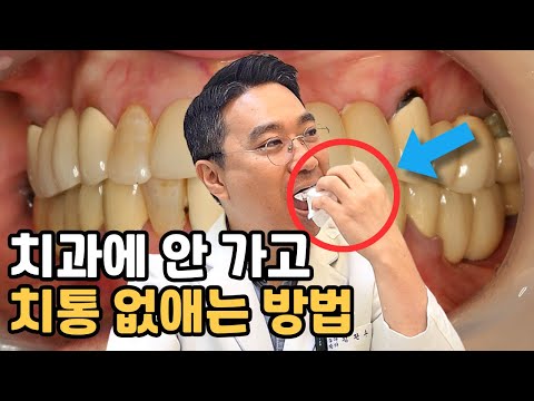 🦷치통! 병원 안 가고 없애는 방법! 응급처치 5가지! 소염 진통제 타이레놀 vs 탁센