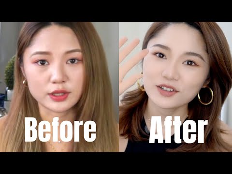 这些年做过的医美项目总结｜翻车血泪史｜瘦脸针 泪沟填充 抗老医美 玻尿酸 ｜ninido