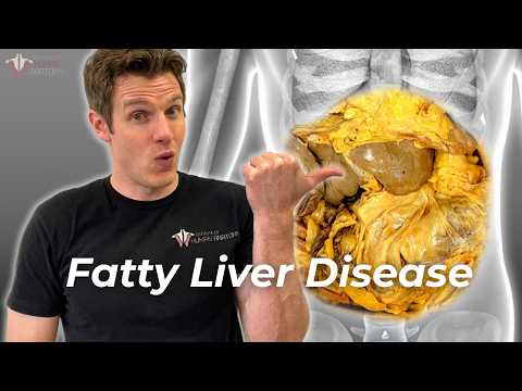 Is Your Liver in Danger? Understanding Fatty Liver Disease