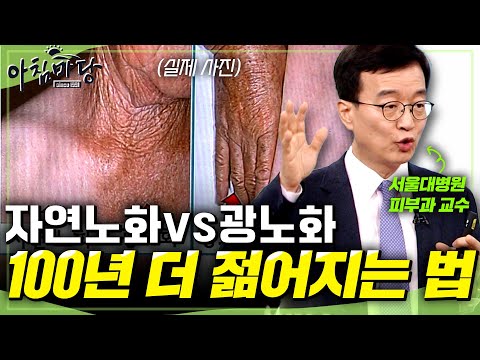 [아침마당] 50대부터 시작되는 급격한 노화를 막아라! 건강과 직결된 피부 100년은 더 젊어지는 법✨ㅣKBS 2017.05.04