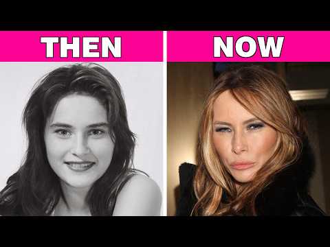 70+ Celebrity Transformations So Extreme Fans Are Worried | Then and Now!