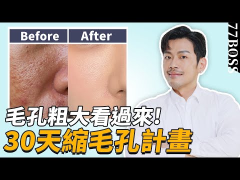 毛孔粗大像插秧？30天縮毛孔計畫，學會這招打造0毛孔美肌！！【77老大】