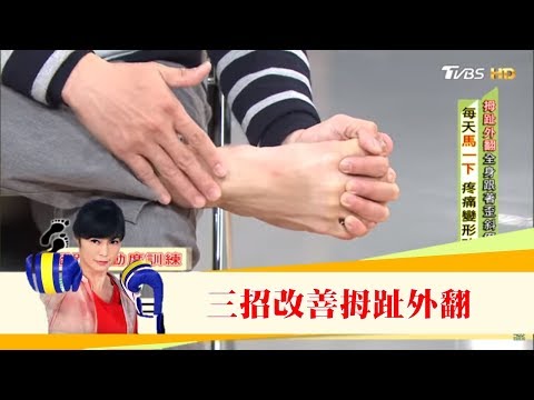 腰痛查不出原因，竟是「拇指外翻」造成的！三招改善讓腳不變形 健康2.0