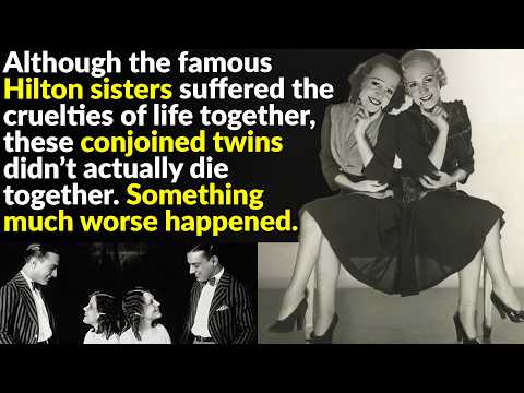 The Tragic Lives of Conjoined Twins Daisy & Violet Hilton