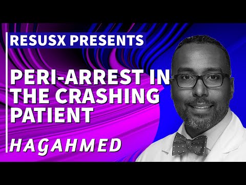 How do you manage patients who are peri-arrest?