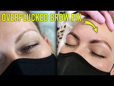 My Secret Weapon for Fixing Overplucked Thin Brows (One Time Treatment)