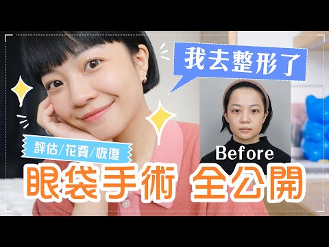 我偷偷整形了🤫淚溝掰掰！價錢診所大公開！麻醉小插曲？連肚臍也抽脂？