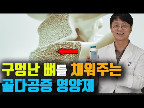뼈를 단단하게 채워주는 필수 영양소,  갱년기 골다공증에 필수 영양제를 안내드립니다.