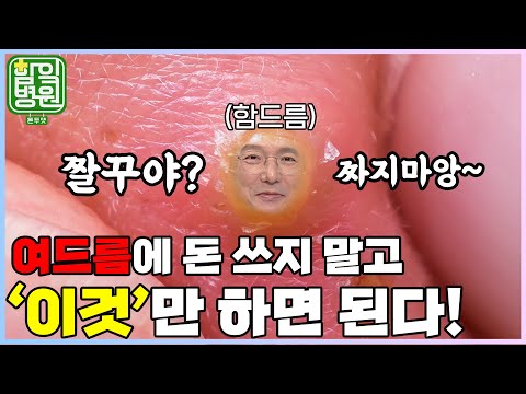 [함잌병원 Full 🏣Ep10] 남녀노소 고민거리 여드름! 짜지마! 이거만 해! 여드름