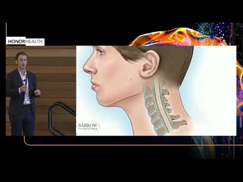 Cervical Myelopathy & Radiculopathy , Core Knowledge for Management and Surgical Treatment