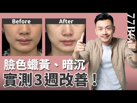 臉色蠟黃、暗沉,3週快速改善,實測效果超級厲害!【77老大】