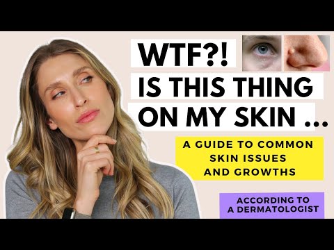 A Dermatologist's Guide to Skin Growths | Dr. Sam Ellis