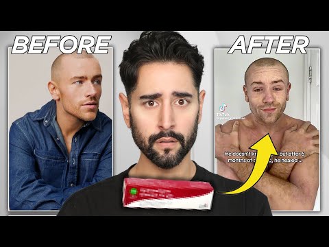 The Skin Condition That Doesn’t Exist... But Everyone Could Suffer From - When Beauty Turns Ugly