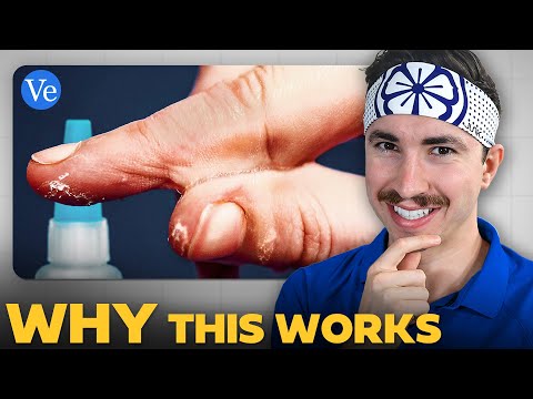 How Did Veritasium Earn 12M Views With This Thumbnail?