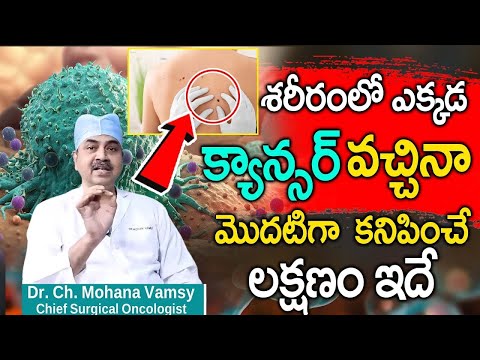 ఒంట్లో కాన్సర్ కణాలు ఉంటె కనిపించే సూచనలు || Dr.Mohan Vamsi About Cancer || iD Health 360