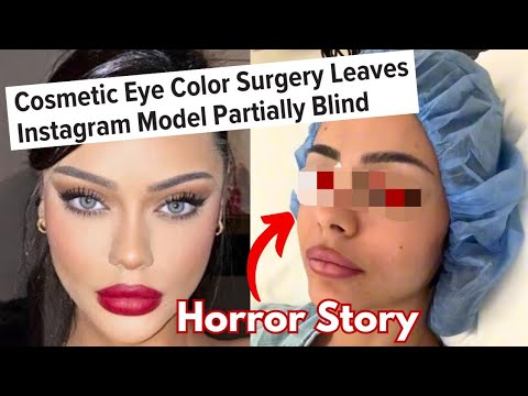 Blind For Beauty: Why Doctors Refuse To Perform This Surgery