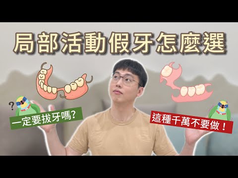 局部活動假牙怎麼選？最常見的形式是什麼？活動假牙一定要拔牙嗎？拔牙必要條件＋有什麼類型一次講清楚！ #活動假牙 #假牙 #局部活動假牙