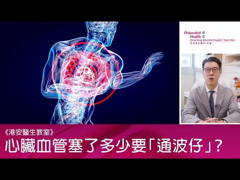 【港安醫生教室—心臟血管塞了多少要通波仔？】