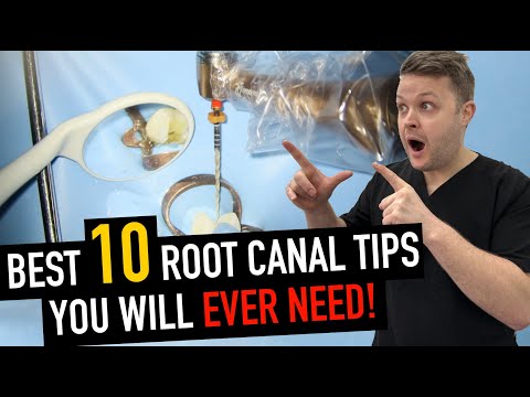 10 Game-Changing Root Canal Tips (You’ll Use Tomorrow!)