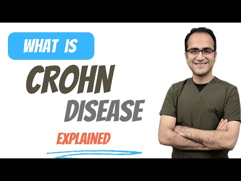 Crohn's Disease Sign and Symptoms, Crohn Vs Ulcerative Colitis, Pathology, Treatment Lecture USMLE