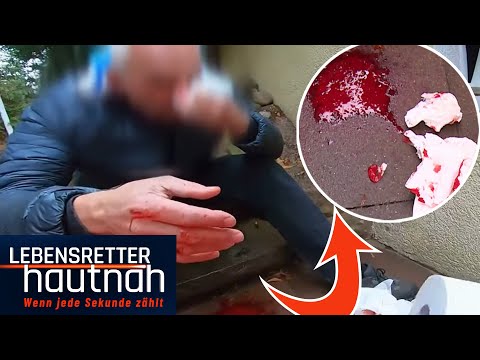 Extremer Blutverlust: David & Micha stehen vor riesen Rätsel!! | Lebensretter hautnah | SAT.1