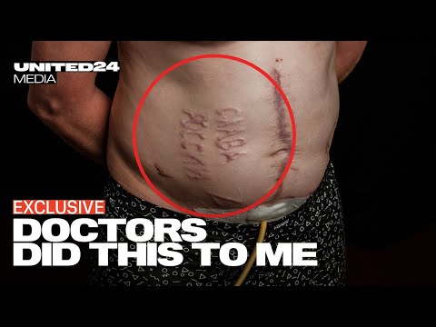 They burned “Glory to Russia” into my body. Ukrainian POW’s Story of Survival and Torture