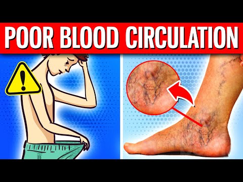10 WARNING Signs You Have POOR Blood Flow (Circulation)