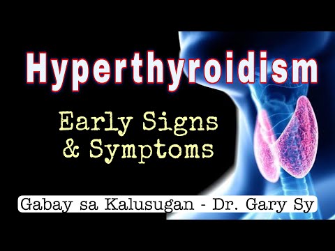 Hyperthyroidism: Early Signs & Symptoms - Dr. Gary Sy