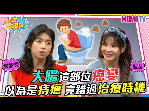 當心大腸癌! 大腸這部位癌變 以為是痔瘡 竟錯過治療時機?! 20220915 鍾雲霓 甄莉【小宇宙大爆發】完整版