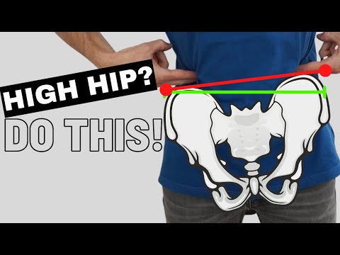How To Self Correct (FIX) a High Hip (Uneven Pelvis)