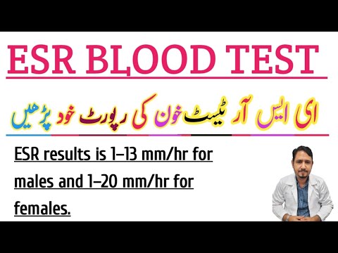 ESR BLOOD TEST (Urdu Hindi)  Irfan Azeem
