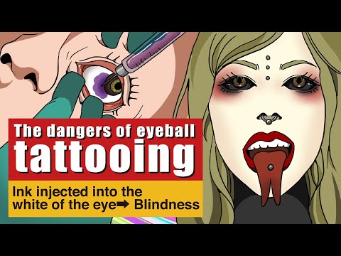【Manga】Eyeball Tattoo - crisis of blindness