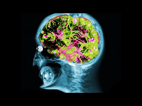 A Man Dry Scooped 35000 Milligrams Caffeine. This Is What Happened To His Organs.