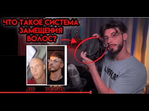 ИСПОЛЬЗУЮ СИСТЕМУ ЗАМЕЩЕНИЯ ВОЛОС 5 ЛЕТ. СТОИТ ЛИ ПОКУПАТЬ? ЧЕСТНЫЙ ОТЗЫВ!