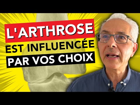 Ces 3 erreurs silencieuses qui vous condamnent à l'arthrose [Dr Berenbaum]