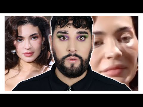 What Happened To Kylie's Face? | Surgery or just bad lighting?